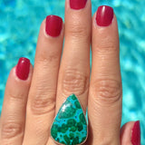 Azurite Malachite Ring